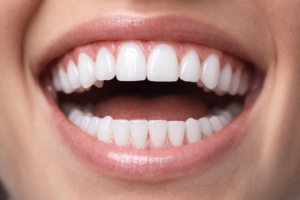 صورة تعبيرية لفم مفتوح تظهر فيه أسنان بيضاء مرتبة